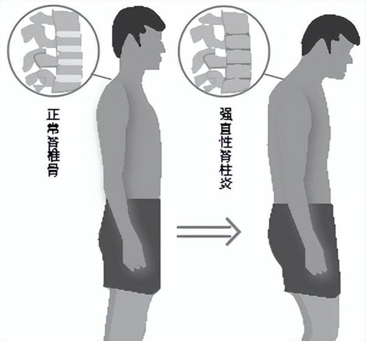 立定脚跟撑起脊梁指什么生肖，时代解答解释落实_fp758.07.68